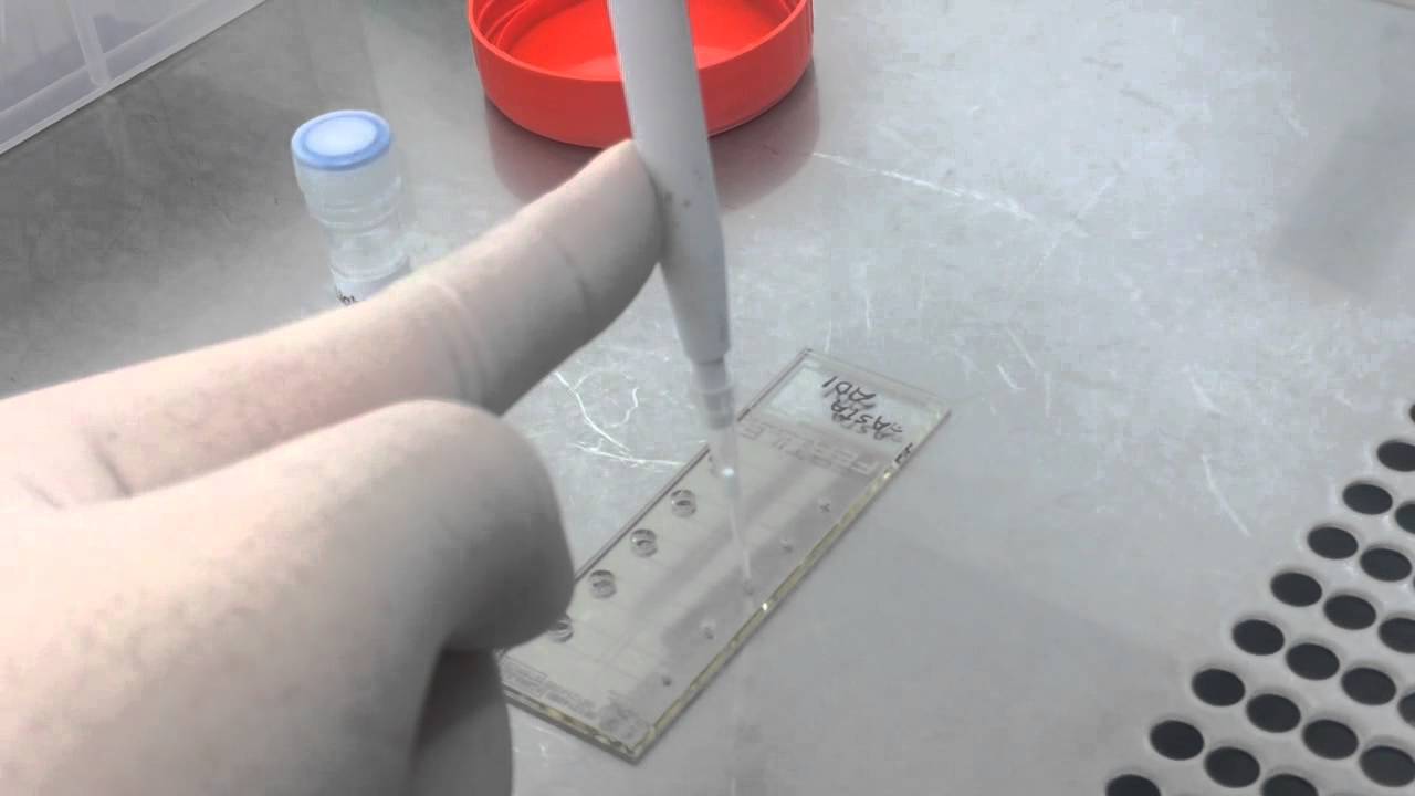 Microchip Method in IVF Treatment